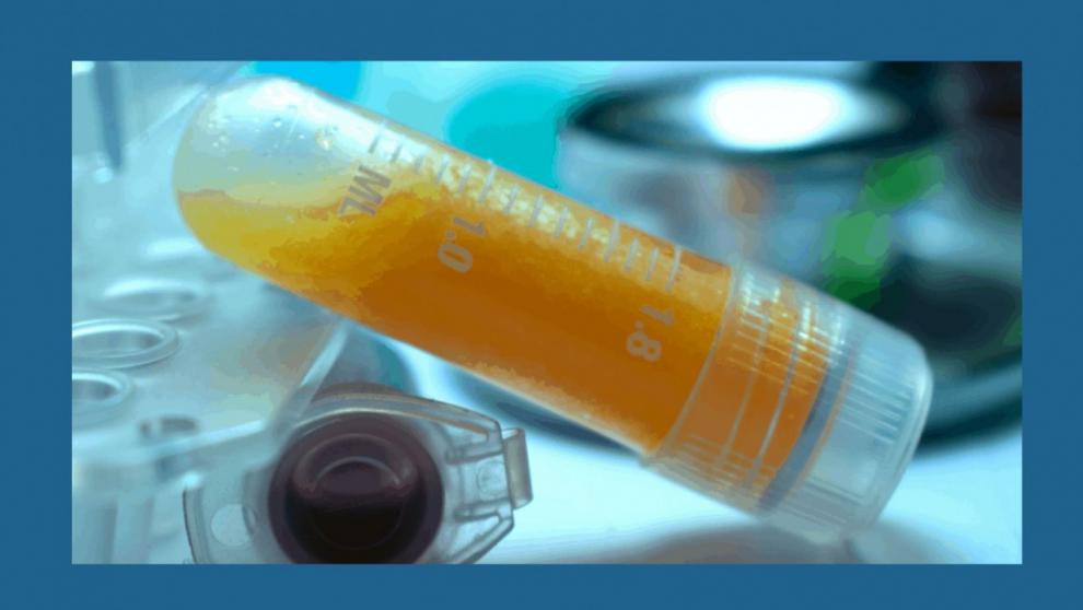 Regeneracin de tejidos con Lipogems - Foto